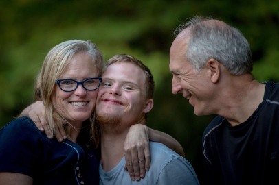 Down sendromu tanısını doğru belirlemede yüzde 99.9 başarı